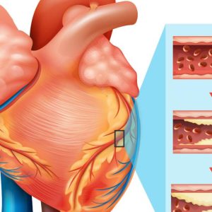 HeartDiseases_axen_analytics